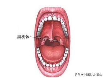 头条问答 儿子三岁半扁桃体发炎怎么办 19个回答