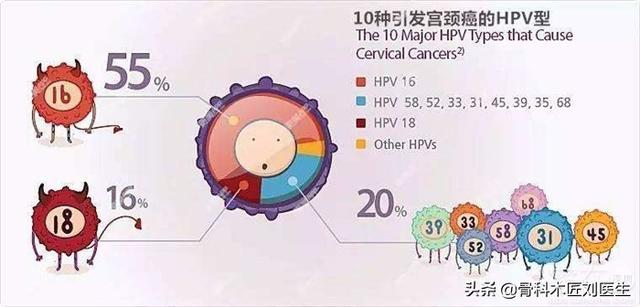 宫颈癌发出的第一个信号:宫颈癌需要关注哪些信号？