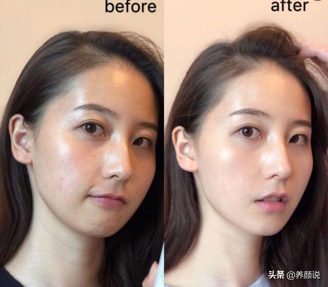 如何改善肌肤问题,才能蜕变成女神?