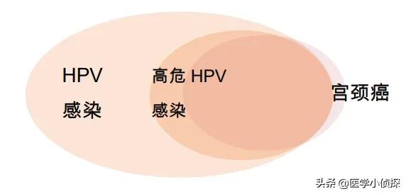 疣状表皮发育不良:女子打过hpv疫苗，6年后却查出宫颈癌，疫苗不管用吗，为何？