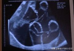 如何别致地宣布怀孕？