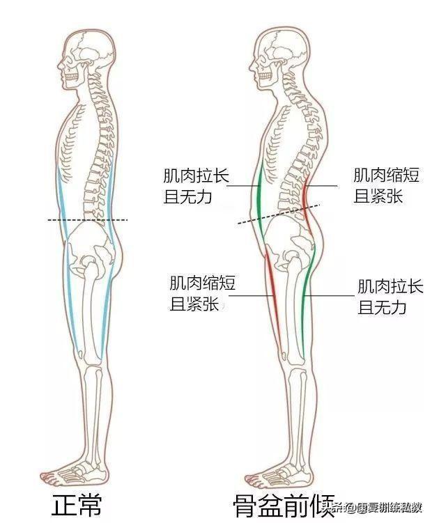 头条问答 - o型腿的人为什么跑不快?(5个回答)