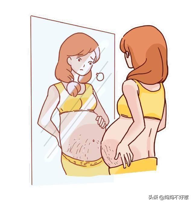 怀孕多久会长妊娠纹？为什么会长妊娠纹？插图19