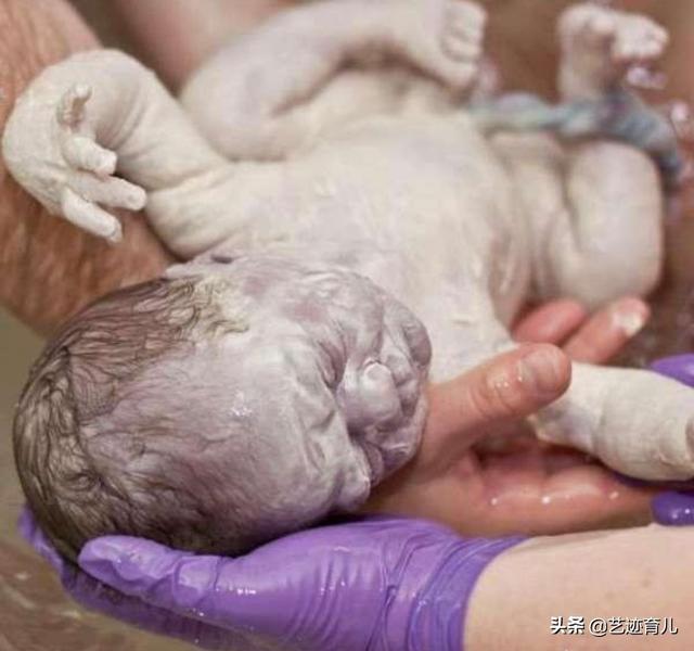 头条问答 - 胎毒是什么,怎么形成的?(8个回答)