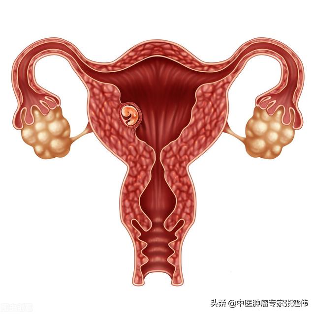 我媽55歲體檢查出來子宮癌晚期,為什麼一點症狀沒有?-育兒網