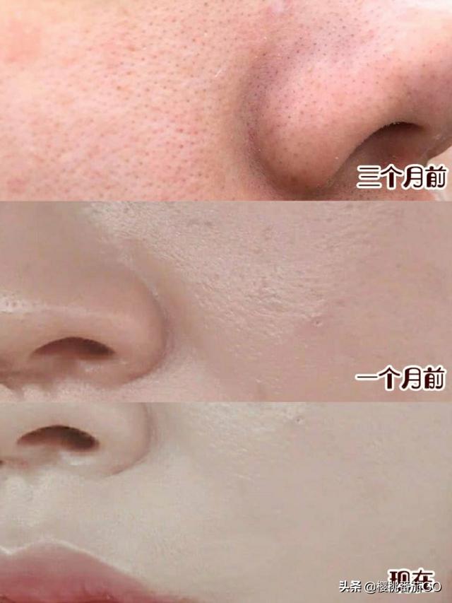 面部清洁:平时的脸部清洁工作你会花多少时间？