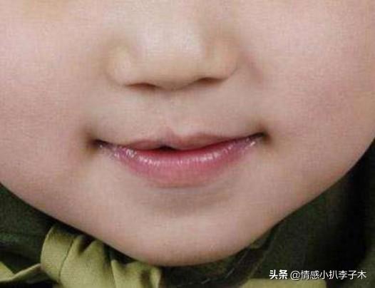 坚持生下唇裂宝宝我被婆婆赶出家门了怎么办