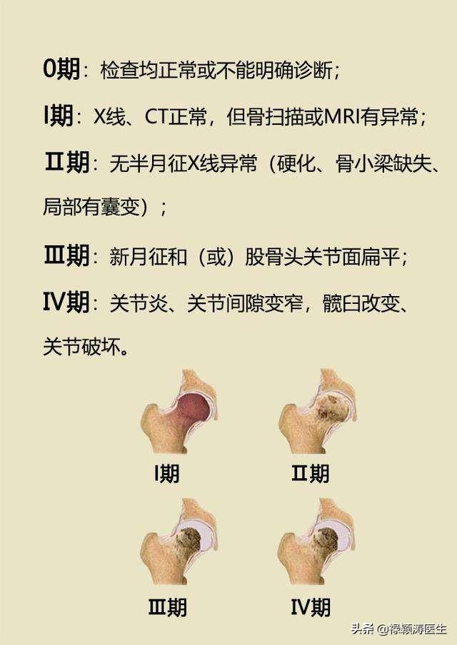 头条问答 - 右侧大腿根部间歇性疼痛,不定时发作,疼
