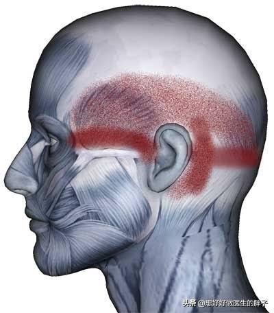本人偏头痛23年了发作时以左侧为主现在转换到头部两边的风池穴位疼