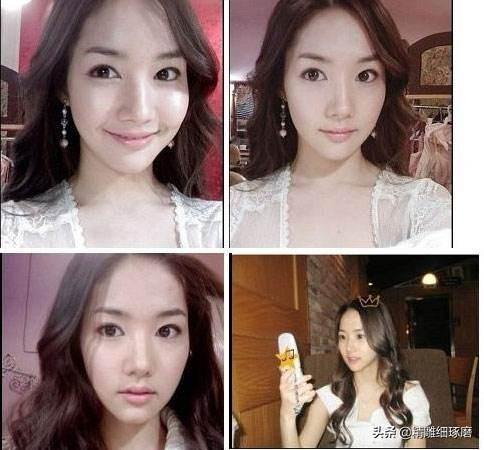 朴敏英整容:为什么朴敏英整了现在也很自然