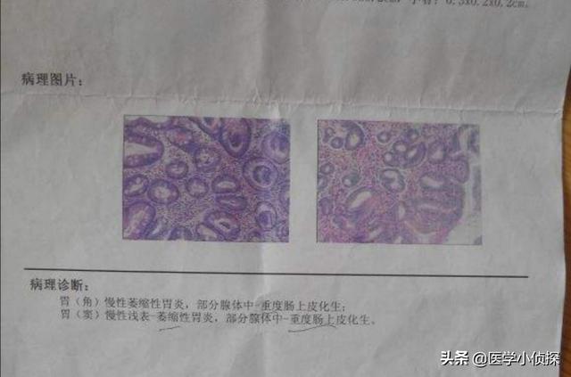 胃炎症状表现有哪些,胃不好的人都有哪些表现？