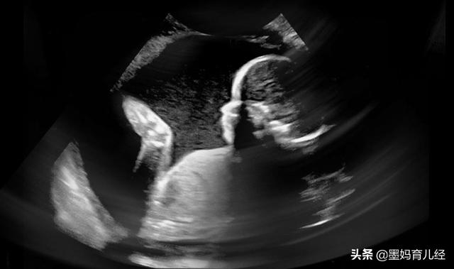 7个月的宝宝发育标准(三个月宝宝发育迟缓)