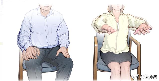莱姆病症状早期以:帕金森综合症早期症状有哪些？