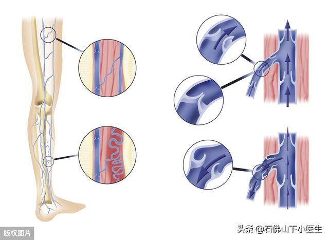 静脉主要在哪?静脉主要分布在哪里