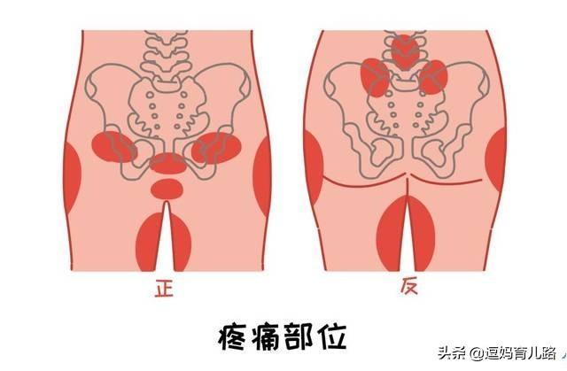 孕妇生产时阵痛都是在哪些部位，产前阵痛究竟是什么样的疼痛