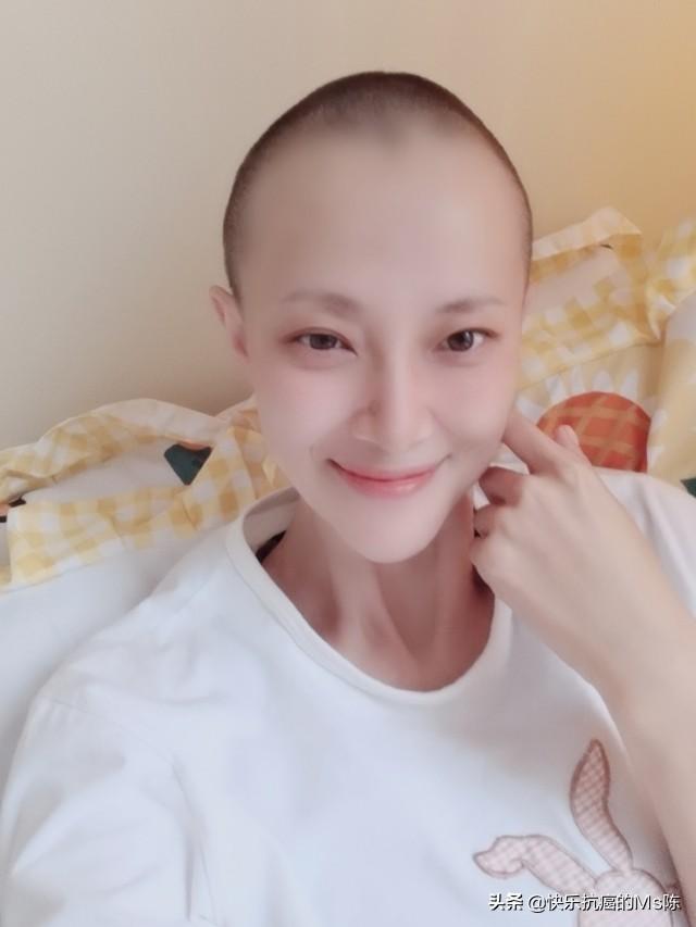 化疗脱发(化疗脱发后还能长出来吗)