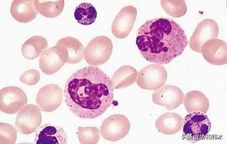 化验单上的箭头是什么意思，血常规怎么看中性粒细胞减少是什么原因