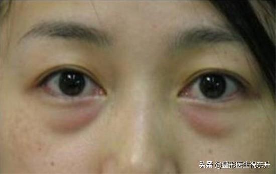 兰芝眼霜怎么样(兰芝眼霜图片)