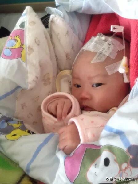 先天性心脏病、室间隔缺损患者应该如何治疗？