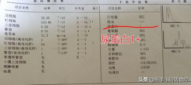 头条问答 体检报告中 尿蛋白 是什么情况 会不会是什么病的前兆 左撇子说医的回答 0赞