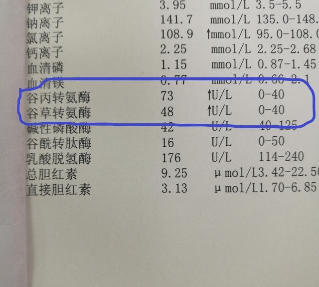 头条问答 体检报告单中 转氨酶 偏高 意味着什么 需要注意什么 196个回答