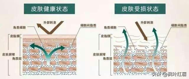 夏季皮肤问题图片:为什么一些人夏天皮肤过敏没冬天多？