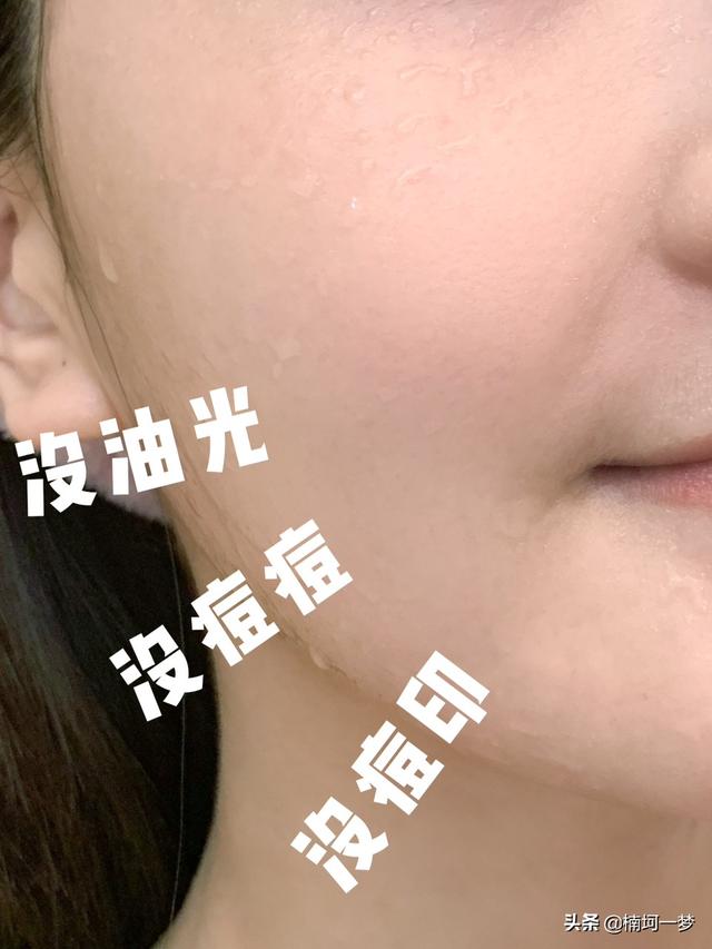 祛痘小偏方,对于祛痘，你都吸取了哪些教训？