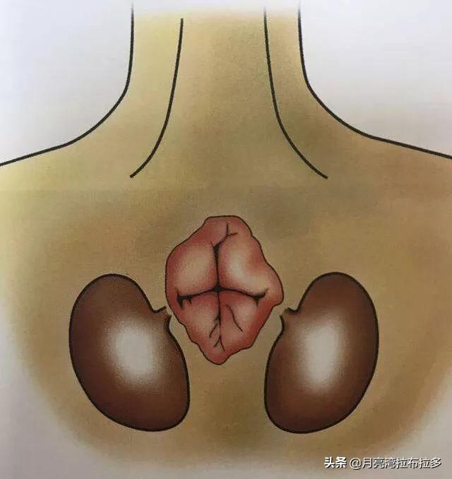 美卡犬要挤肛门:绝育后的狗狗为什么挤不出肛门腺？