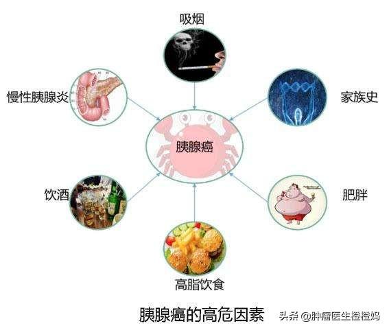 胰腺炎症状:胰腺癌一般是什么导致的？