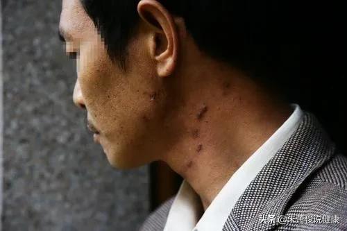 中国艾滋病的现状如何