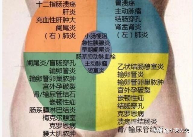 头条问答 左下腹疼痛是怎么回事 长腿医生的回答 0赞