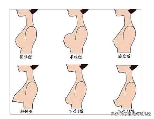 头条问答 - 生产后乳房一定会下垂吗?(圆咕噜00的回答,0赞)