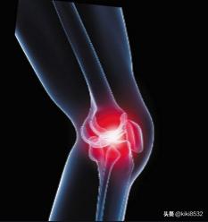 关节炎症状:风湿性关节炎的症状是什么？