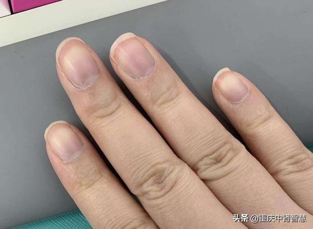 心脏不好指甲会有什么特征?-百科网