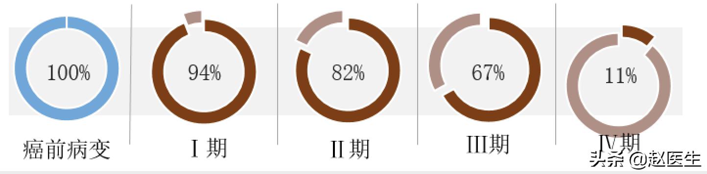 肠癌的早期症状,肠道癌的早期症状什么样？