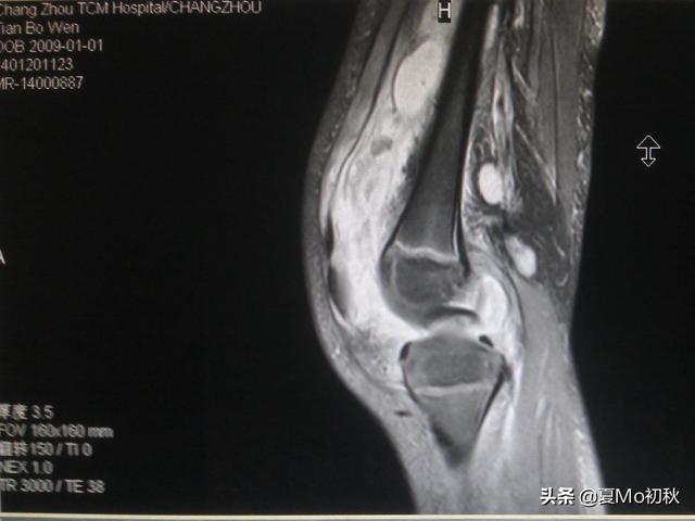 玛氏宠物护理学院限时挑战赛:老人卧床有痰出不来怎么办？