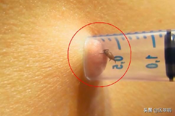 防治牛蜱:牛身上的牛蜱外用什么药好？