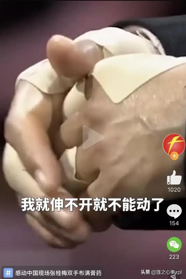 李心草案:张桂梅身体得到治疗了吗？