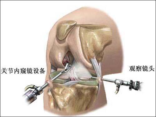 魔兽世界战斗宠物绷带误删:剖腹产的后遗症你们有吗？