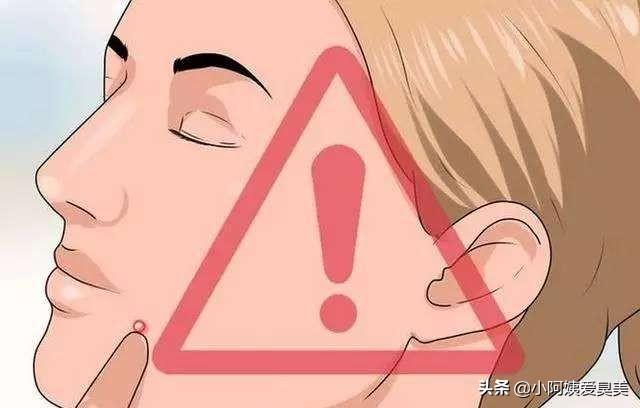 白头粉刺要挤掉吗？还是放着护理好自然就会消除掉？:好自然 第1张