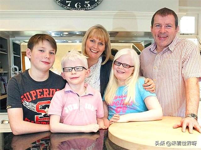 但是欧洲人的白不是白化病的白,也不是近亲繁殖的结果,是由于环境因素