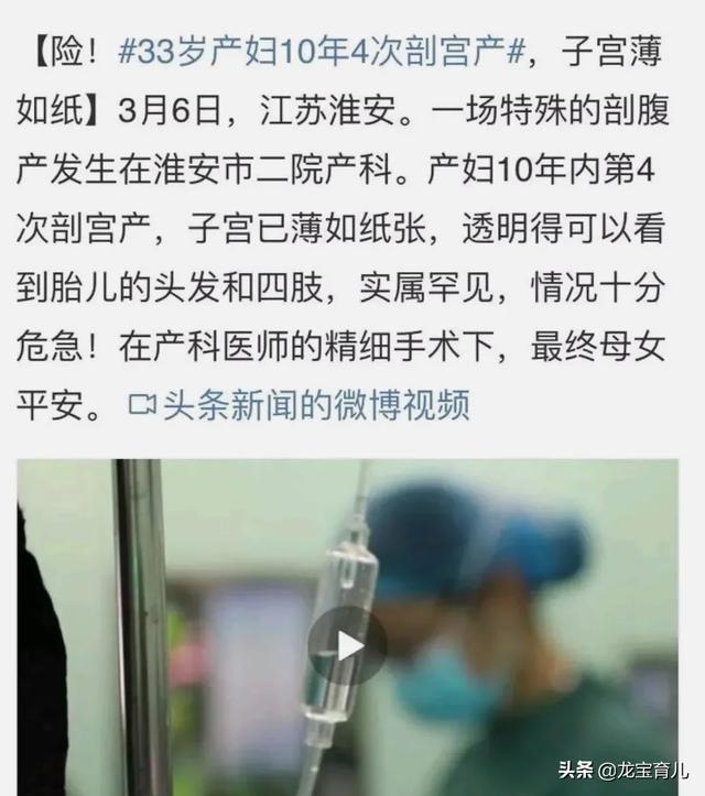 女性最多可以经受几次剖腹产，一胎剖，二胎可以顺产吗？女人可以承受多少次剖宫产？