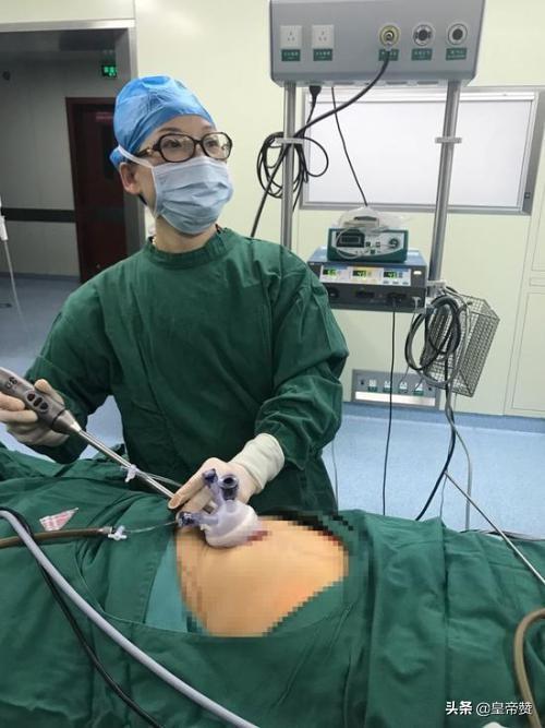 女朋友肚子左右两边和肚脐眼有手术刀口请问是做过什么手术