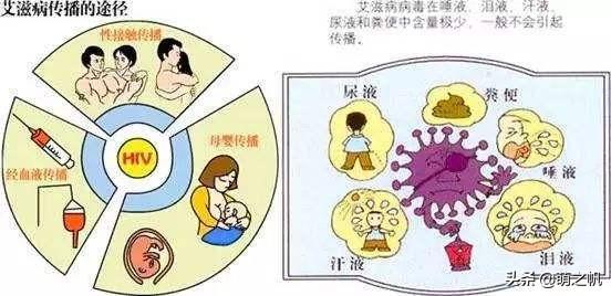 hiv是什么,血检出现-hiv是什么症状？