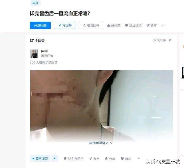 刘欢病情:那英为什么在华语乐坛享有那么高的地位