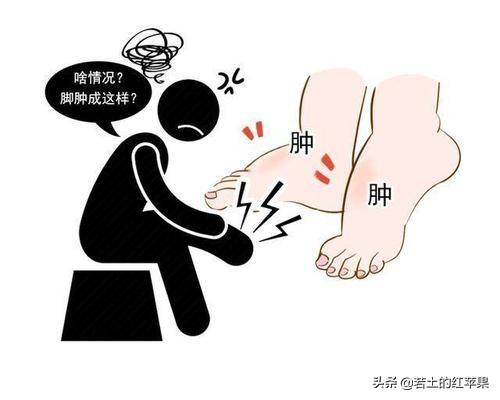 头条问答 - 老人90岁腿肿有水泡什么原因?(1个回答)