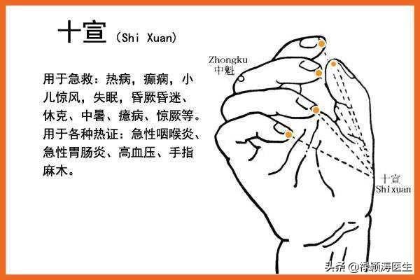 头条问答 - 如果得脑溢血不醒,可以用针刺手脚十指尖出血吗?