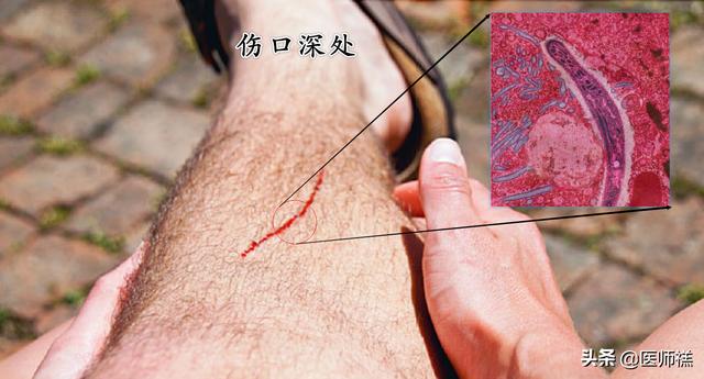被猫抓伤多少天过危险期了:被猫抓超过3个月有狂犬病吗？