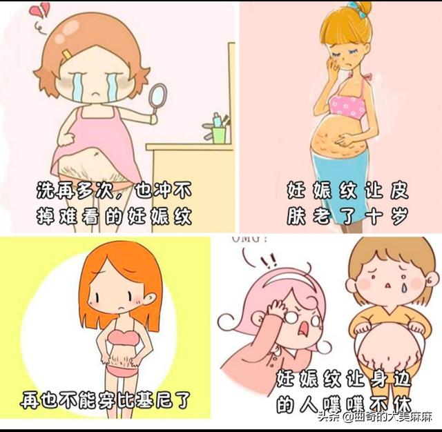 产后如何消除妊娠纹(产后妊娠纹怎么淡化去除)