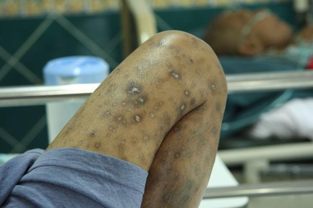 头条问答 - 艾滋病究竟是一种什么病?(10个回答)